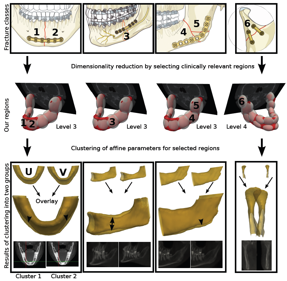 from Seiler et al. MedIA 2012